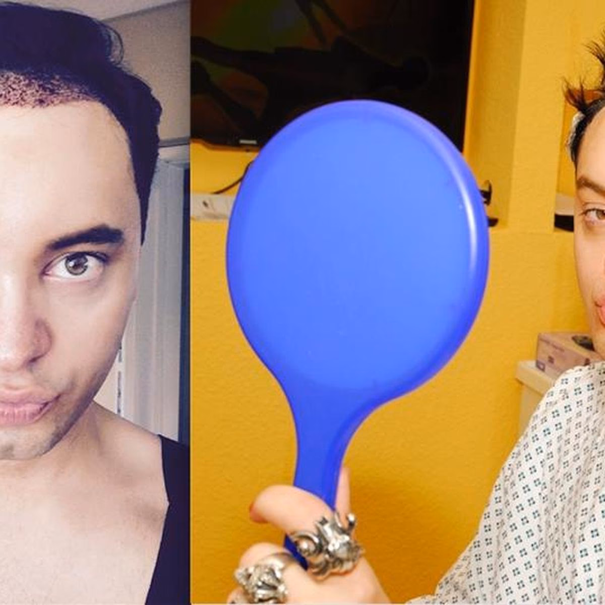 Hat Julian Stöckel Haare?