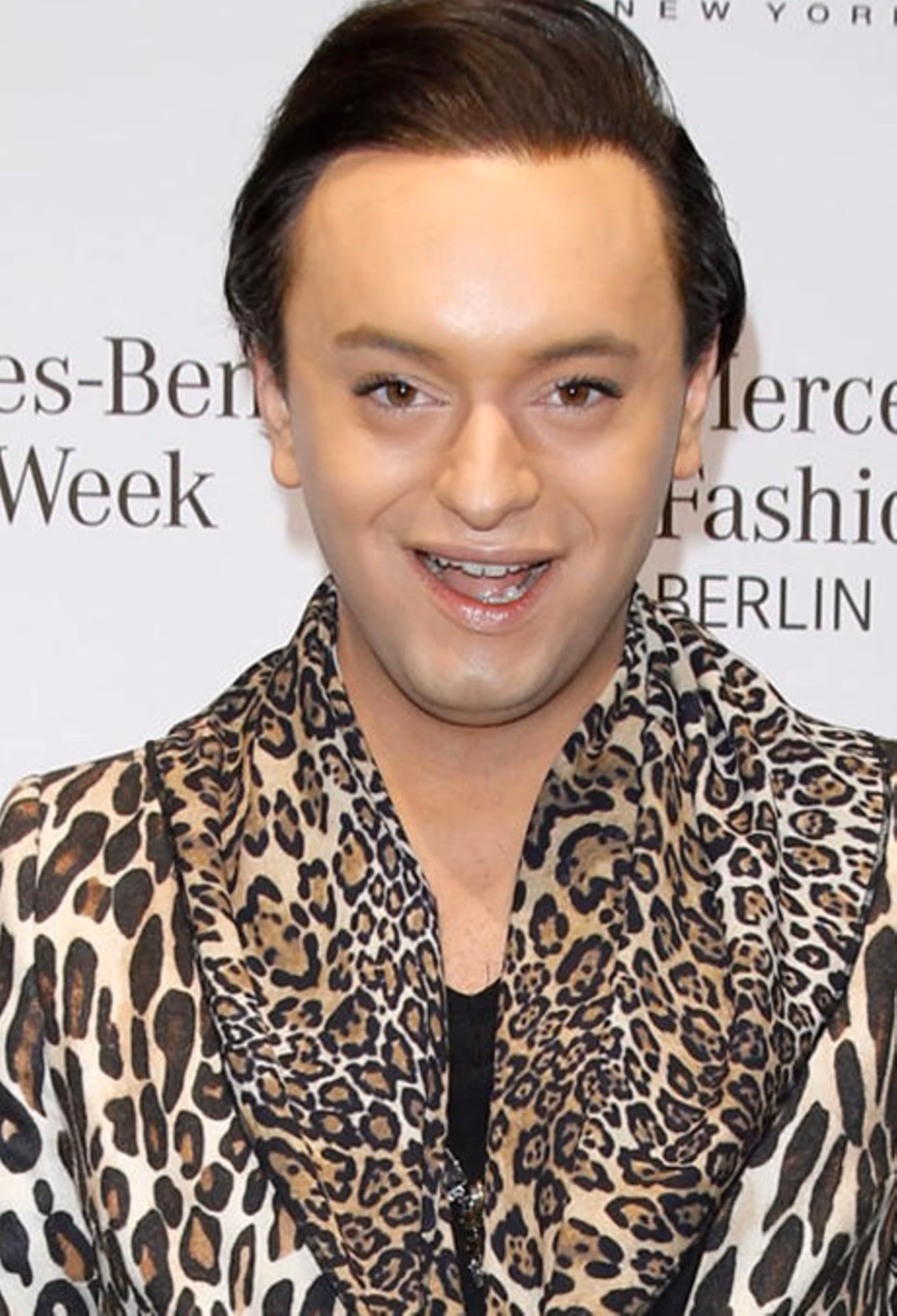 Hat Julian FM Stöckel eine Glatze?